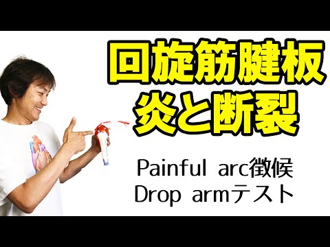 回旋筋腱板炎と断裂（painful arc sign＆drop arm test）：肩関節(Part.8)