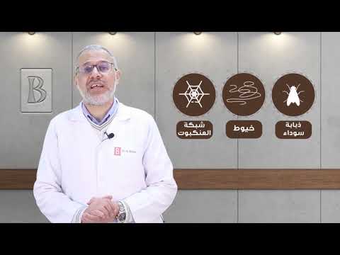 ذبابة العين الطائرة (عوامات العين) الدكتور محمد الديب تخصص دقيق في جراحات الشبكية والسائل الزجاجي.