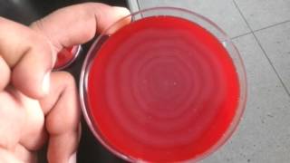 Az enterobacteriaceae spp kenetek férfiakban