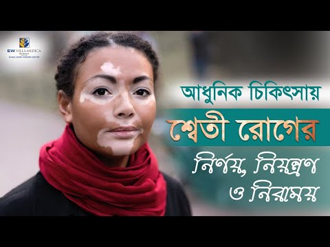 ভিডিও: মুখের ভিটিলিগো নির্ণয় ও চিকিৎসা করার Easy টি সহজ উপায়