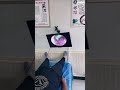耳垢そうじ/耳が痒くなった鼓膜に付着した軟耳垢/ #shorts