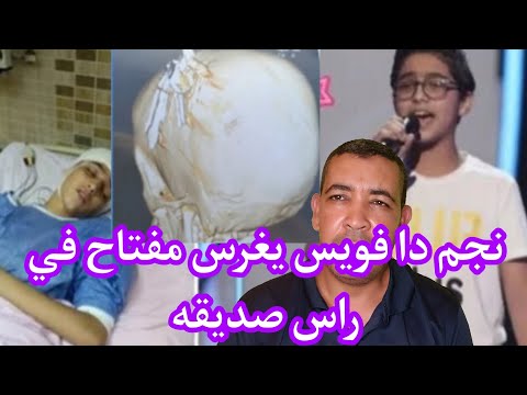 نجم دا فويس معاد عيسى يغرس مفتاح شقة في راس صديقه معاد عيس بالسجن