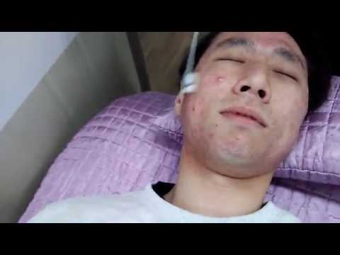 Acne, Cell:ON treatment (the st day of acne conglobata treatment)