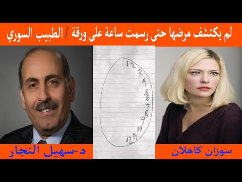 لم يكتشف مرضها حتى رسمت ساعة على ورقة الطبيب السوري سهيل نجار والمريضة سوزان كاهلان