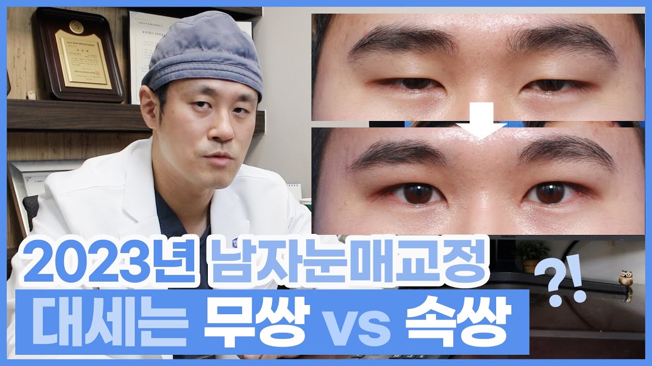 2023년 남자 눈성형 , 눈매교정 대세는 ? 속쌍 vs 무쌍 - YouTube