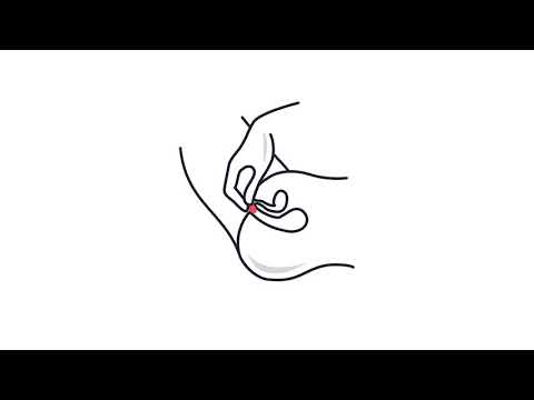 Video: Hur man använder födelsekontrollsvampen