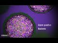 How Antibiotic Resistance Happens - YouTube