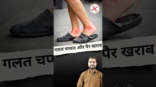 दर्द घुटनों में है... गलती चप्पल की है! #physiovedicclinic #kneepain #hippain #balance #footwear