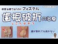歯の破折(歯が割れる)は治療が難しく、フィステルの原因となります。
