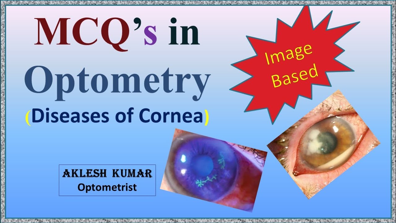 MCQ'S IN OPTOMETRY | Diseases of Cornea | Part 21