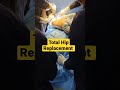 Total hip replacement surgery  live hip surgery  hipreplacementsurgery hipreplacement hippain