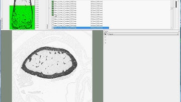 Setting the cortical VOI for mouse femur