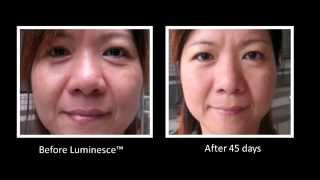 Jeunesse Global LUMINESCE Cellular Rejuvenation Serum Amazing Before & After Photos(, 2013-12-11T01:23:18.000Z)
