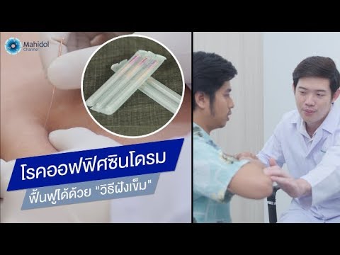 โรคออฟฟิศซินโดรม ฟื้นฟูได้ด้วย "วิธีฝังเข็ม" : พบหมอมหิดล [by Mahidol Channel]