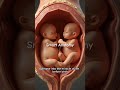 Twin babies communicating  and playing in the womb  #twins #pregnant #anatomy #ovulation