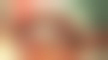 Left trisectionectomy for type X perihilar cholangiocarcinoma