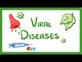 GCSE Biology - What Is a Virus? - Examples of Viral Disease (HIV, Measles & TMV)  #36