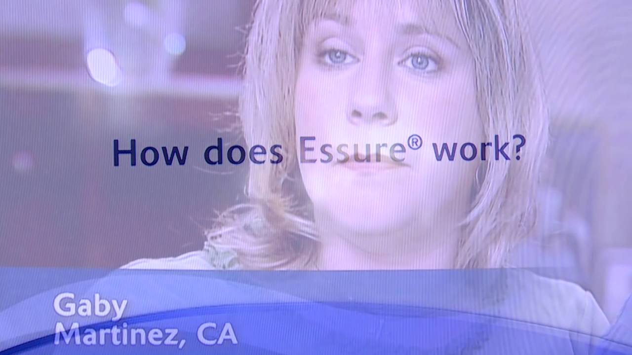 ESSURE Investigation