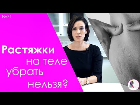 Растяжки на теле убрать нельзя?