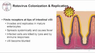 Acute GI: Watery diarrhea and viruses