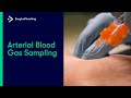 Arterial Blood Gas (ABG) Sampling | Everything You Need to Know to Perform this Vital Procedure