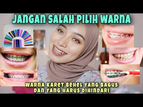 Video: Warna Kawat Gigi: Warna Apa Yang Tersedia Dan Cara Memilih