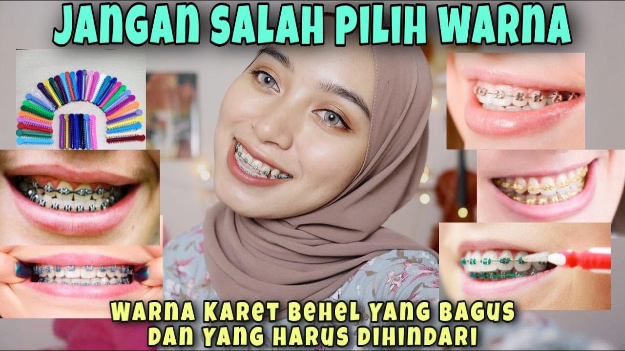 Tips Cara Mudah Memilih Warna Karet Behel ll Wajib Tau 