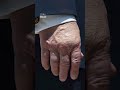 Trump returns to hospital for THIRD time in 13 months