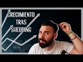 ¿CUÁNDO CRECE el CABELLO CAÍDO por SHEDDING?