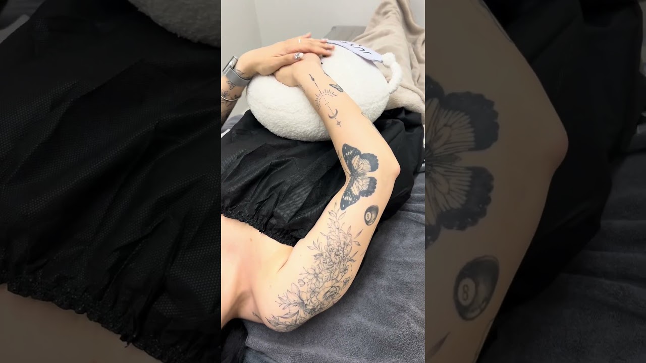 [美麗綻放醫美診所] 妊娠紋？皮膚鬆弛？ONDA 就是您需要的！ #護膚 #水光肌 #拉提 #抗衰老 #首爾 #韓國 #推薦