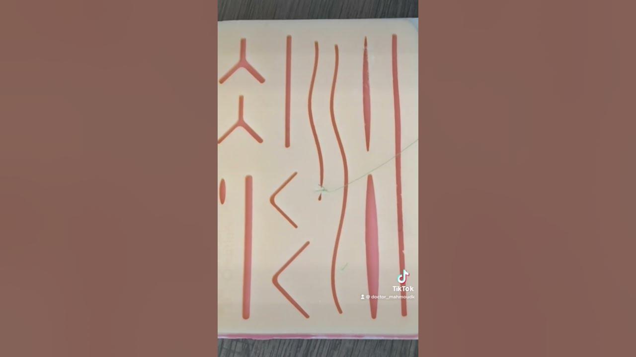 running-locking-suture-ford-interlocking-suture-youtube