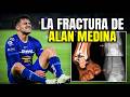 La terrible LESION de Alan Medina | Análisis médico