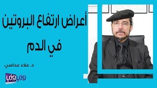 أعراض ارتفاع البروتين في الدم