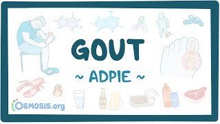 Gout: Nursing Process