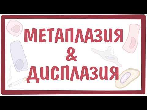 Видео: Что из следующего является примером метаплазии?