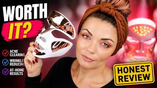 Don't Buy The Dr. Dennis Gross LED Mask Without Watching This!