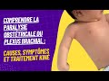 Comprendre la paralysie obsttricale du plexus brachial causes symptmes et solutions