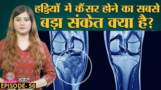 Bone Cancer से बचने का उपाय Doctors से जान लीजिए | Sehat Ep 56 screenshot 5