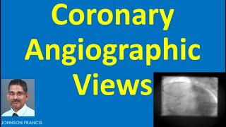 Coronary Angiographic Views