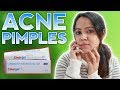Get rid of *Acne & Pimples* effective Clear Gel || Review || Clear Gel ||