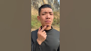 How I Cured a Bug Bite with Yogurt in the Wild | Survival Hacks #shots