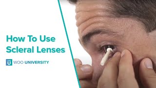 How To Insert and Remove Scleral Lenses