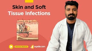 Skin and Soft Tissue Infections | Clinical Medicine | Video Lectures | Medical V-Learning screenshot 1