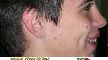 Tutorial Gimp 2.6 - how to get rid of acne, mole and blemishes