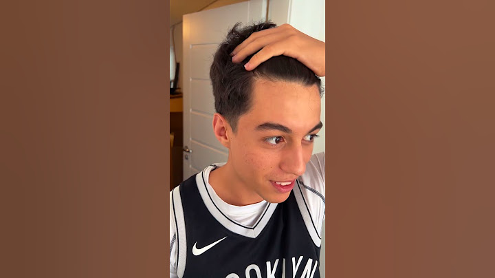 Olha Essa Calvície Dele 🤣 #shorts