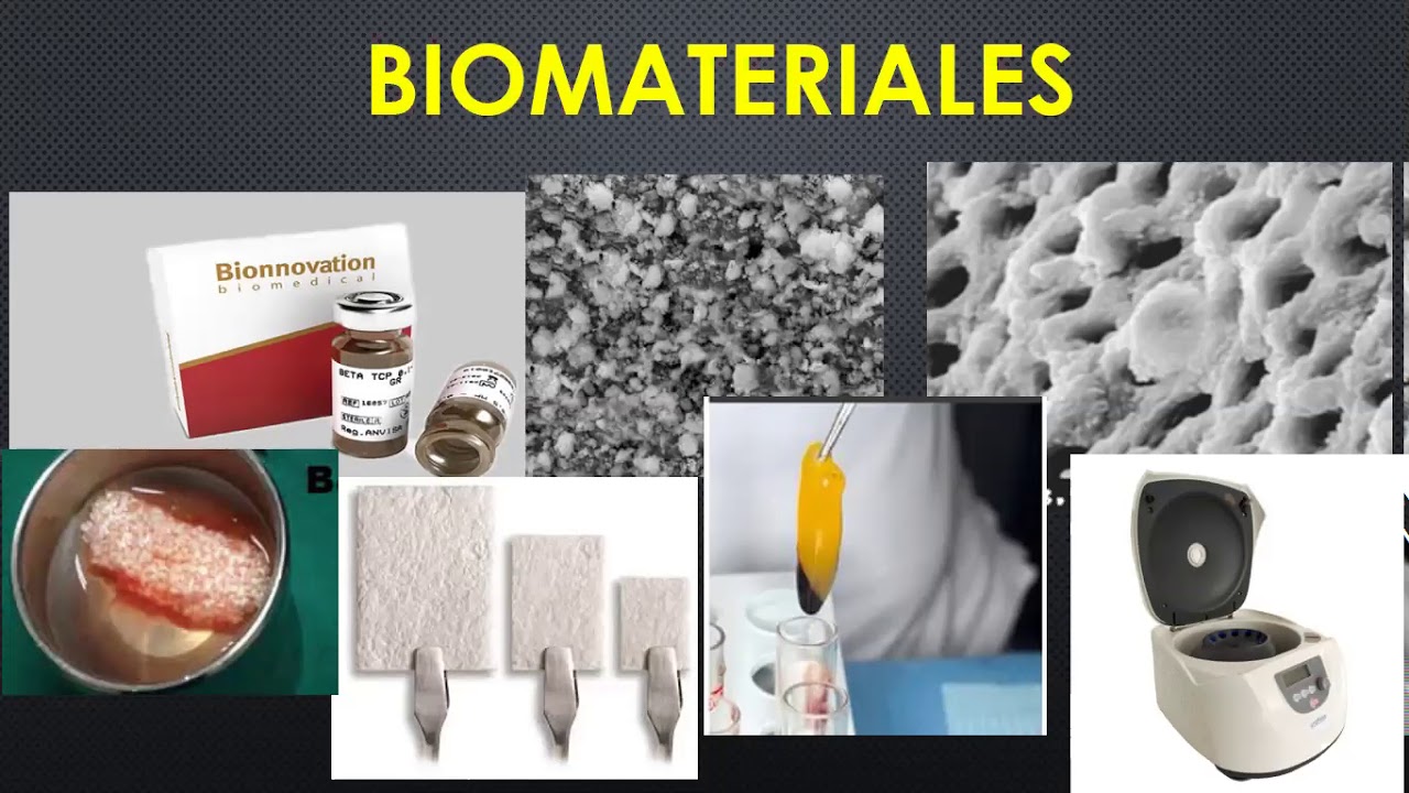 BIOMATERIALES APLICADOS EN IMPLANTOLOGIA ORAL YouTube