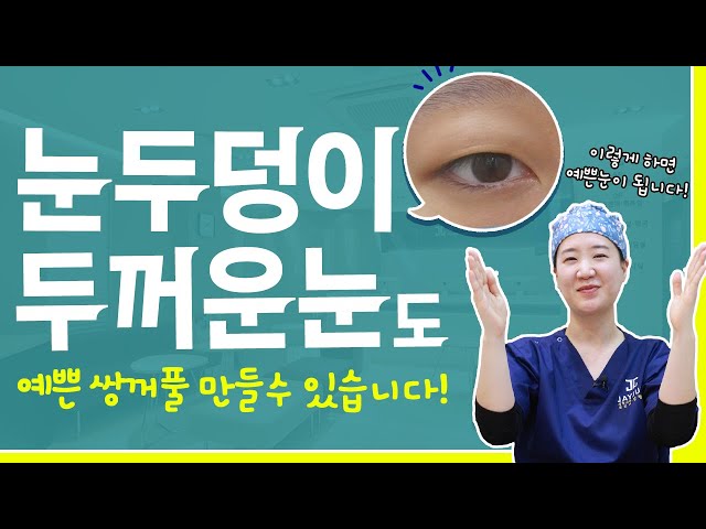 눈두덩이가 두꺼워 쌍수하면 안 예쁠까 걱정된다면 이 영상을 꼭~ 보세요!