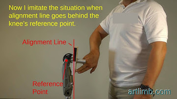 ArtLimb EduVideo Knee Alignment