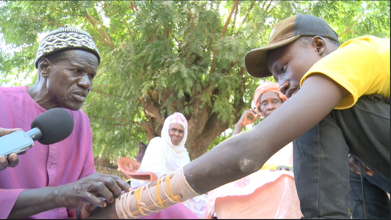 Incroya##  BIRAME SINE : Un GUERISSEUR de Fracture 