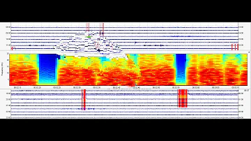 ALERT Yellowstone Magma Just 600 ft Below the Ground!!!